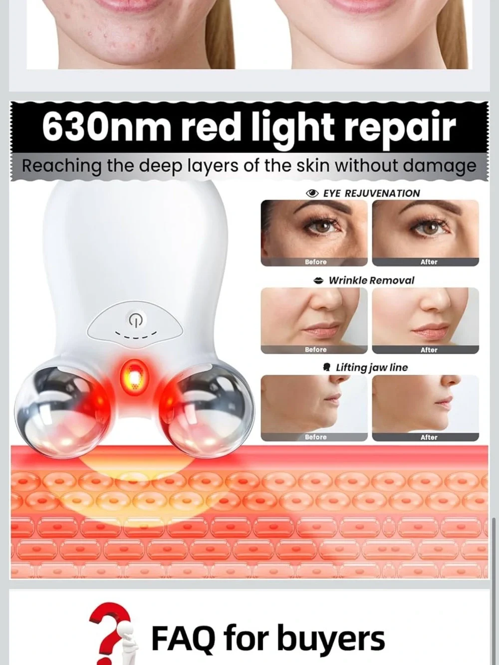 NWB Hunvva Microcurrent Facial Device,Latest Red Light Technology