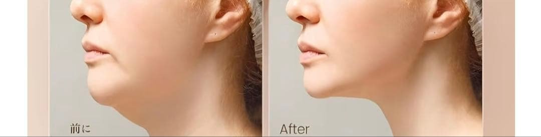 facial lymphatic